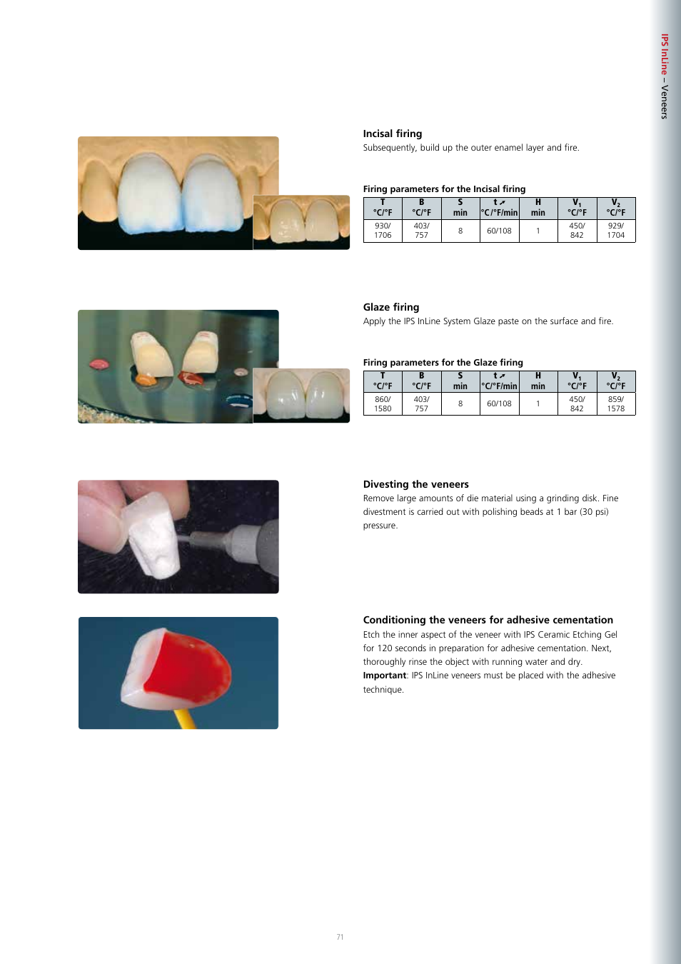 Ivoclar Vivadent IPS InLine System User Manual | Page 71 / 88