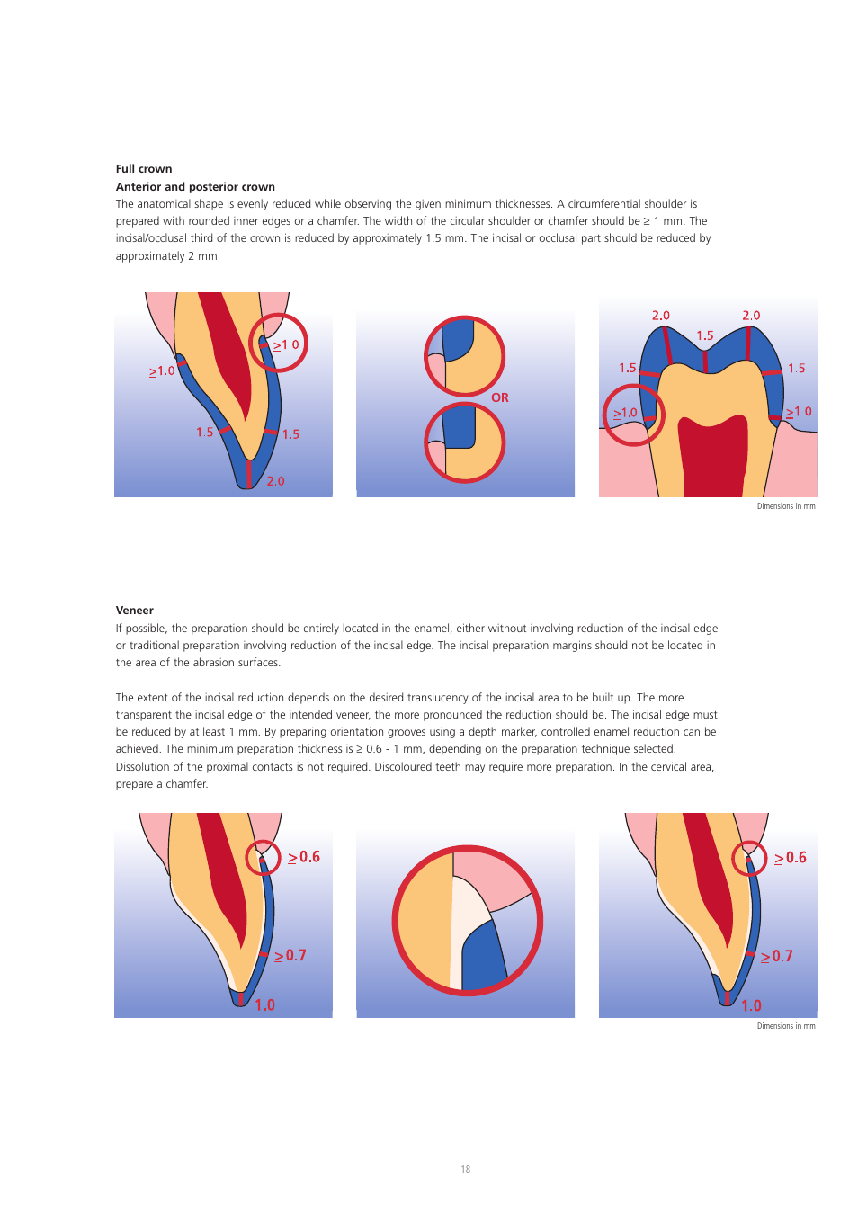 Ivoclar Vivadent IPS Empress Esthetic User Manual | Page 18 / 52