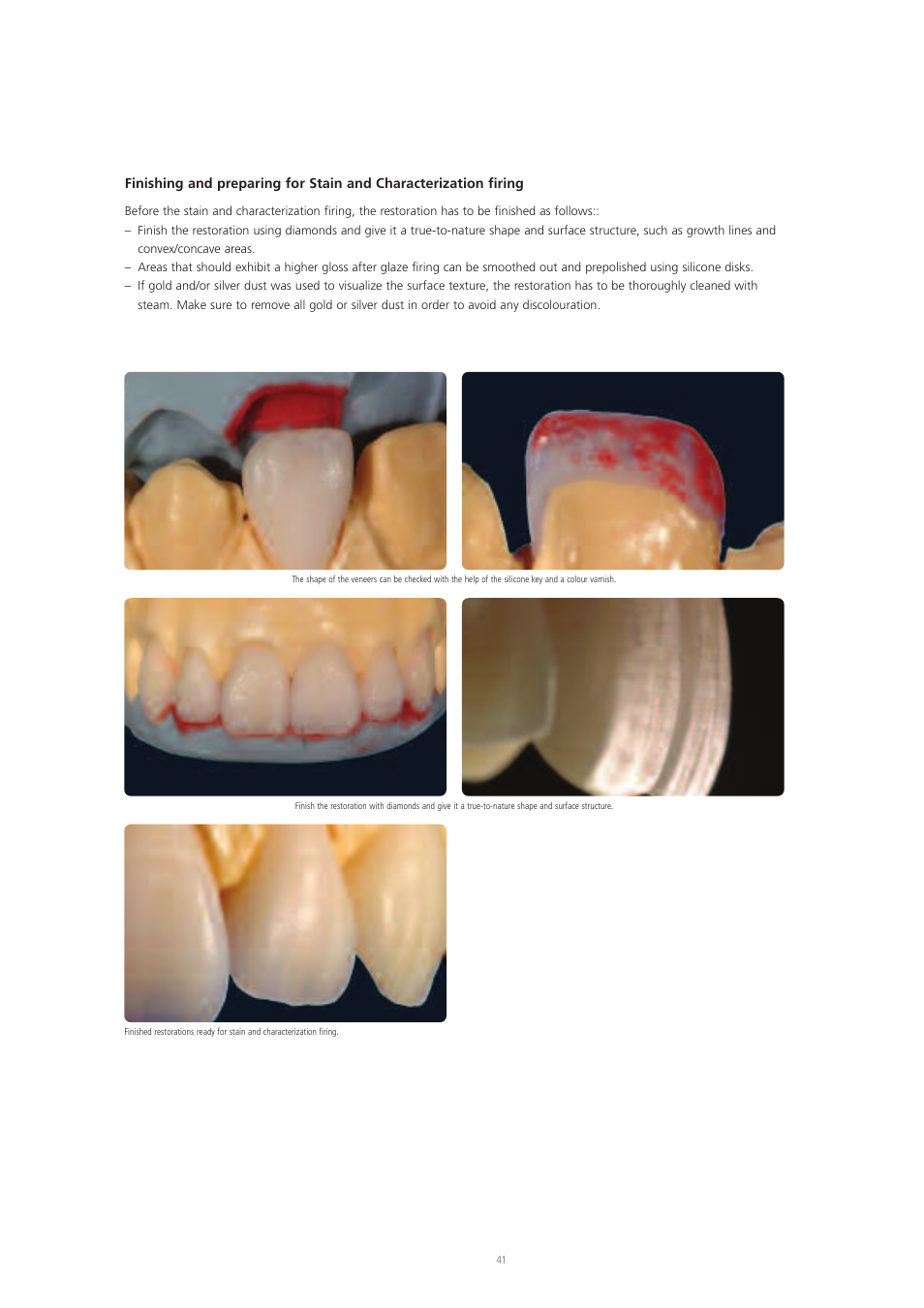 Ivoclar Vivadent IPS Empress Esthetic User Manual | Page 41 / 52