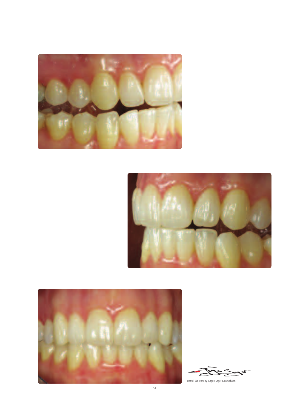 Ivoclar Vivadent IPS Empress Esthetic User Manual | Page 51 / 52