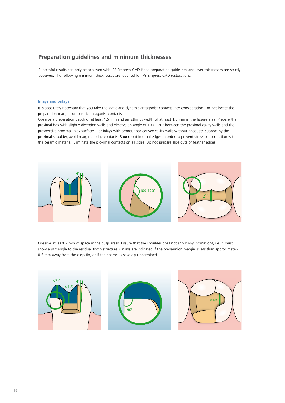 Preparation guidelines and minimum thicknesses | Ivoclar Vivadent PS Empress CAD Chairside User Manual | Page 10 / 40