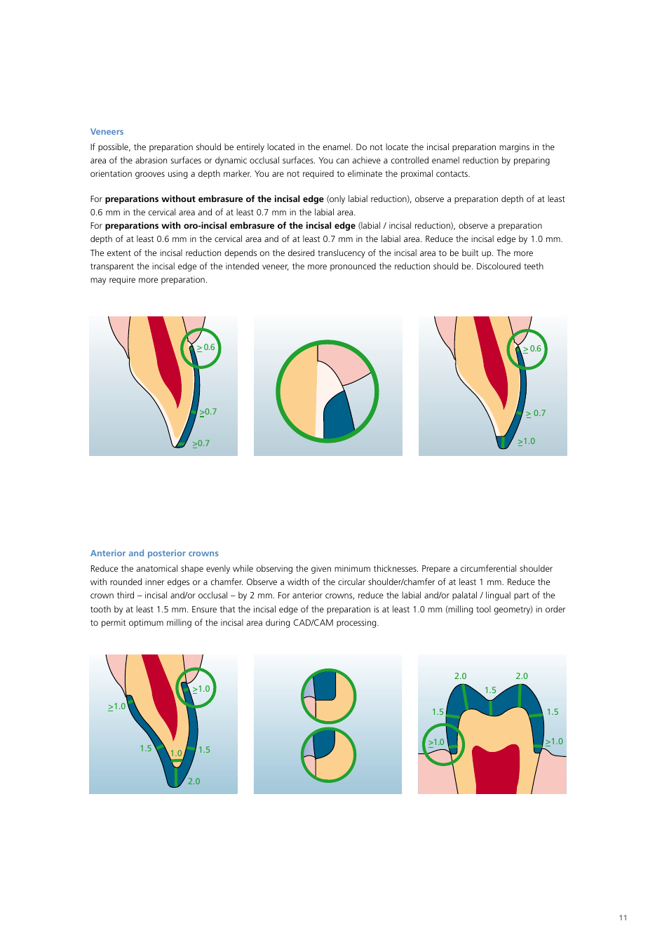 Ivoclar Vivadent PS Empress CAD Chairside User Manual | Page 11 / 40