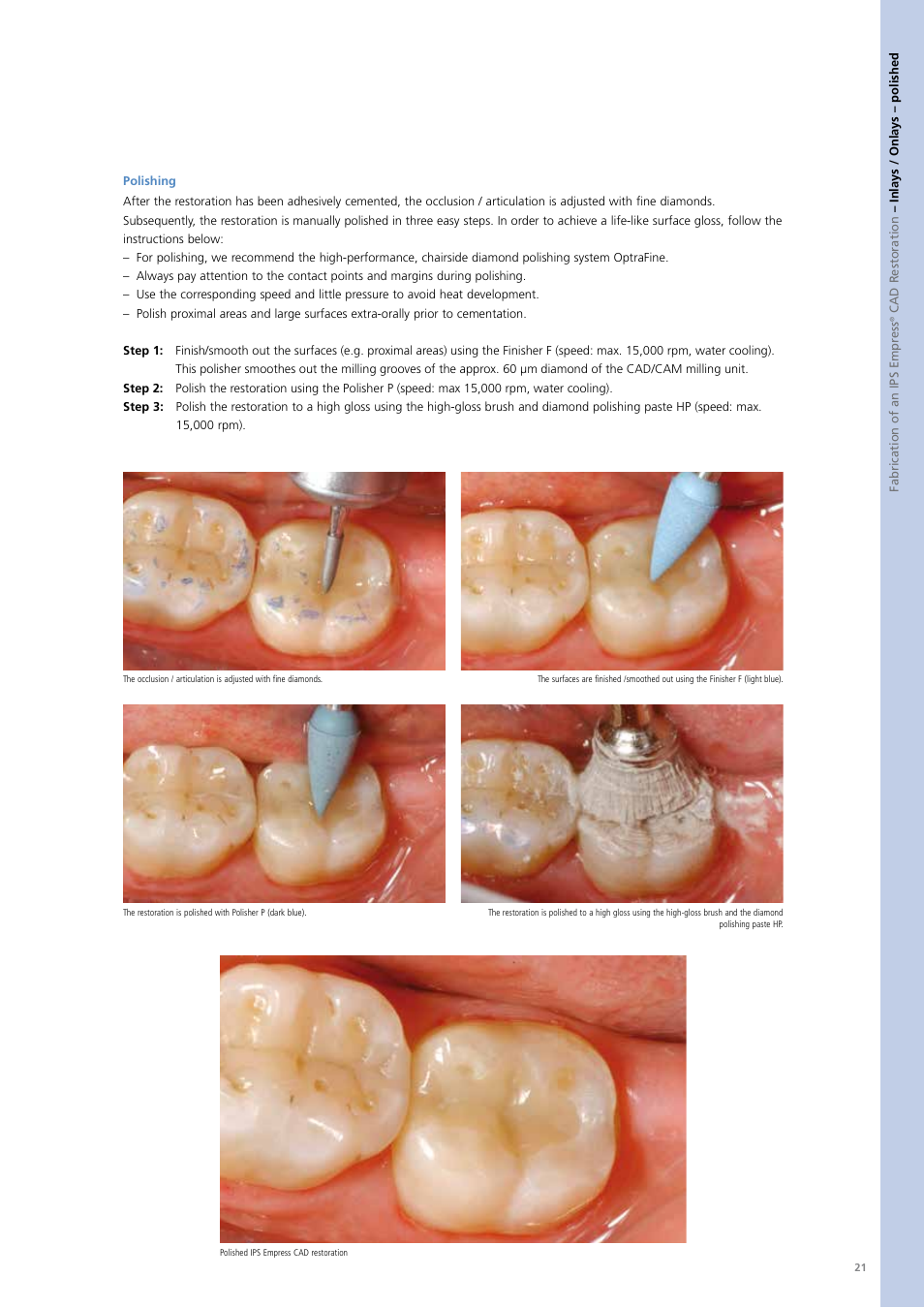 Ivoclar Vivadent PS Empress CAD Chairside User Manual | Page 21 / 40