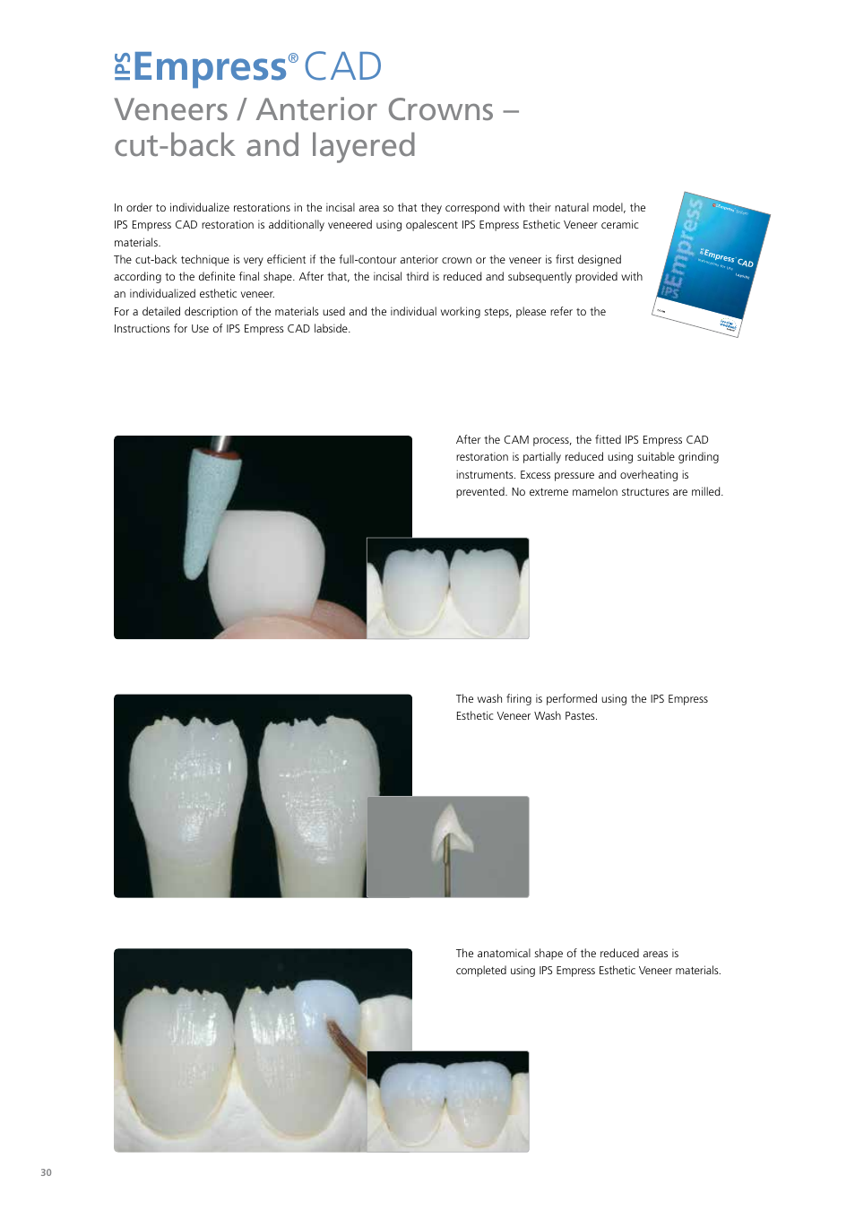 Empress, Veneers / anterior crowns – cut-back and layered | Ivoclar Vivadent PS Empress CAD Chairside User Manual | Page 30 / 40