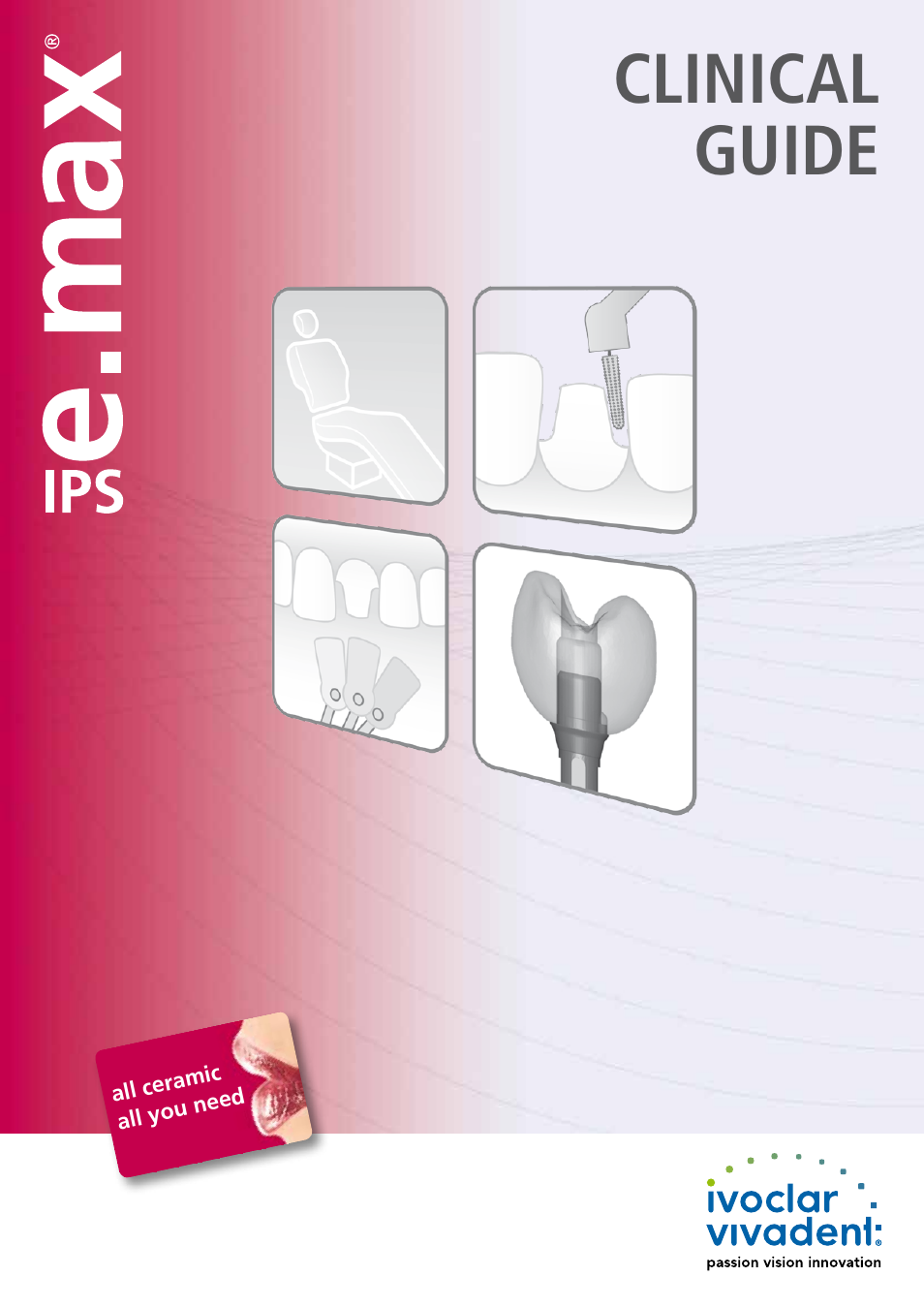 Ivoclar Vivadent IPS e.max Clinical Guide User Manual | 44 pages