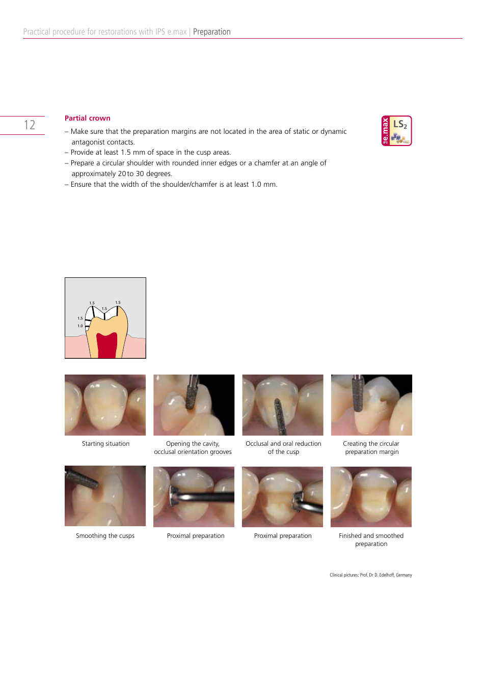 Preparation | Ivoclar Vivadent IPS e.max Clinical Guide User Manual | Page 12 / 44