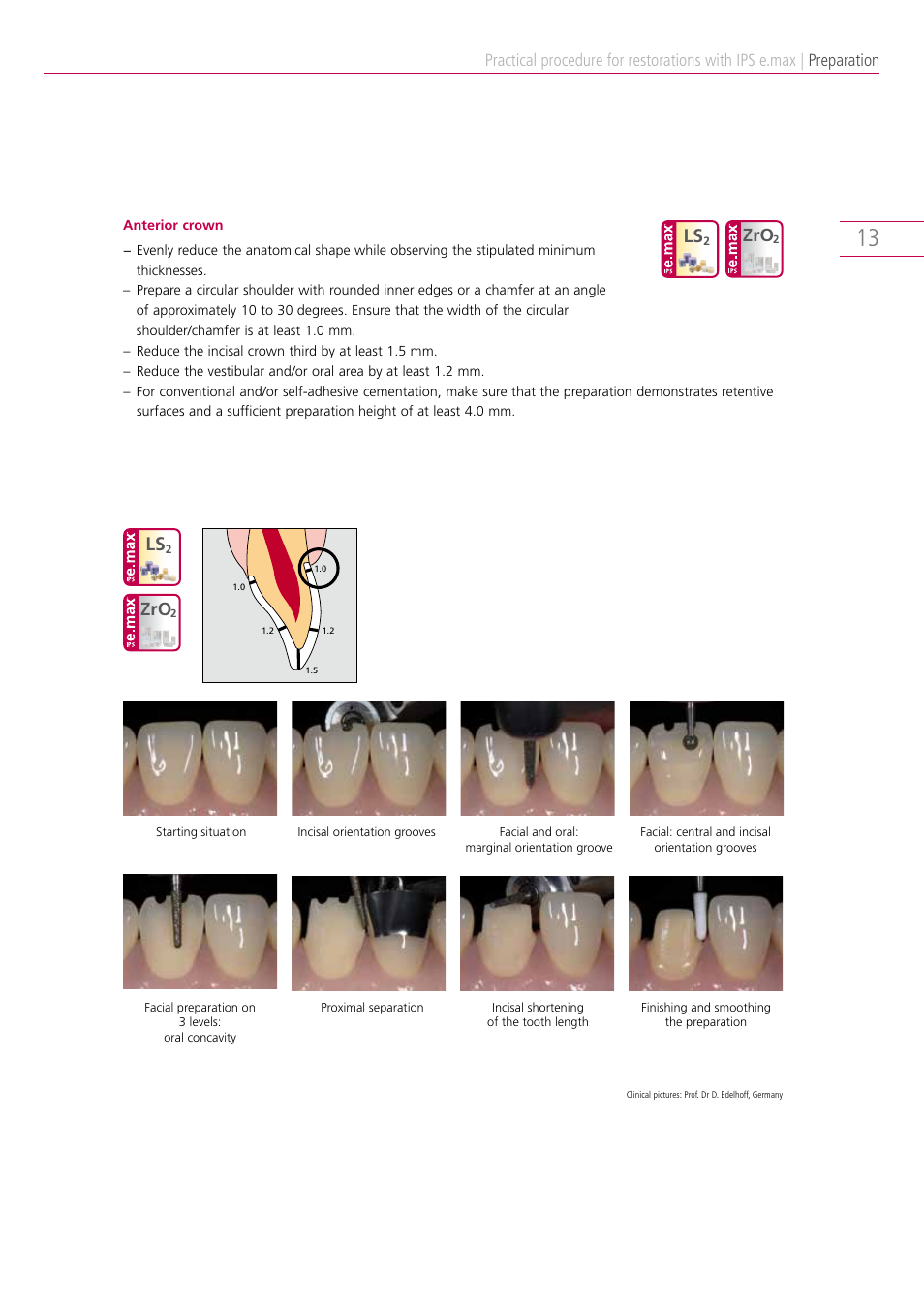 Preparation | Ivoclar Vivadent IPS e.max Clinical Guide User Manual | Page 13 / 44