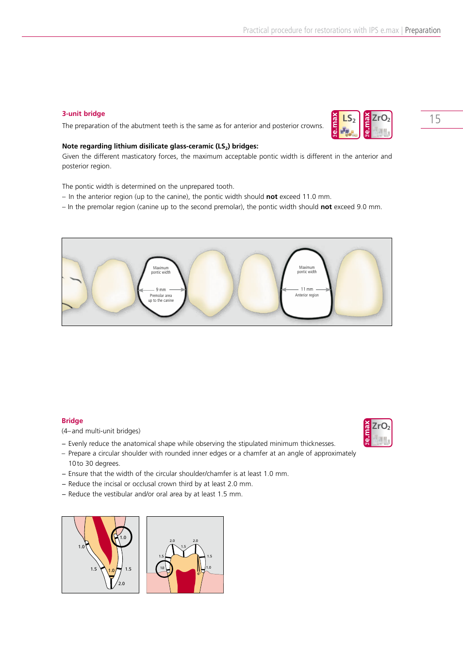 Preparation | Ivoclar Vivadent IPS e.max Clinical Guide User Manual | Page 15 / 44