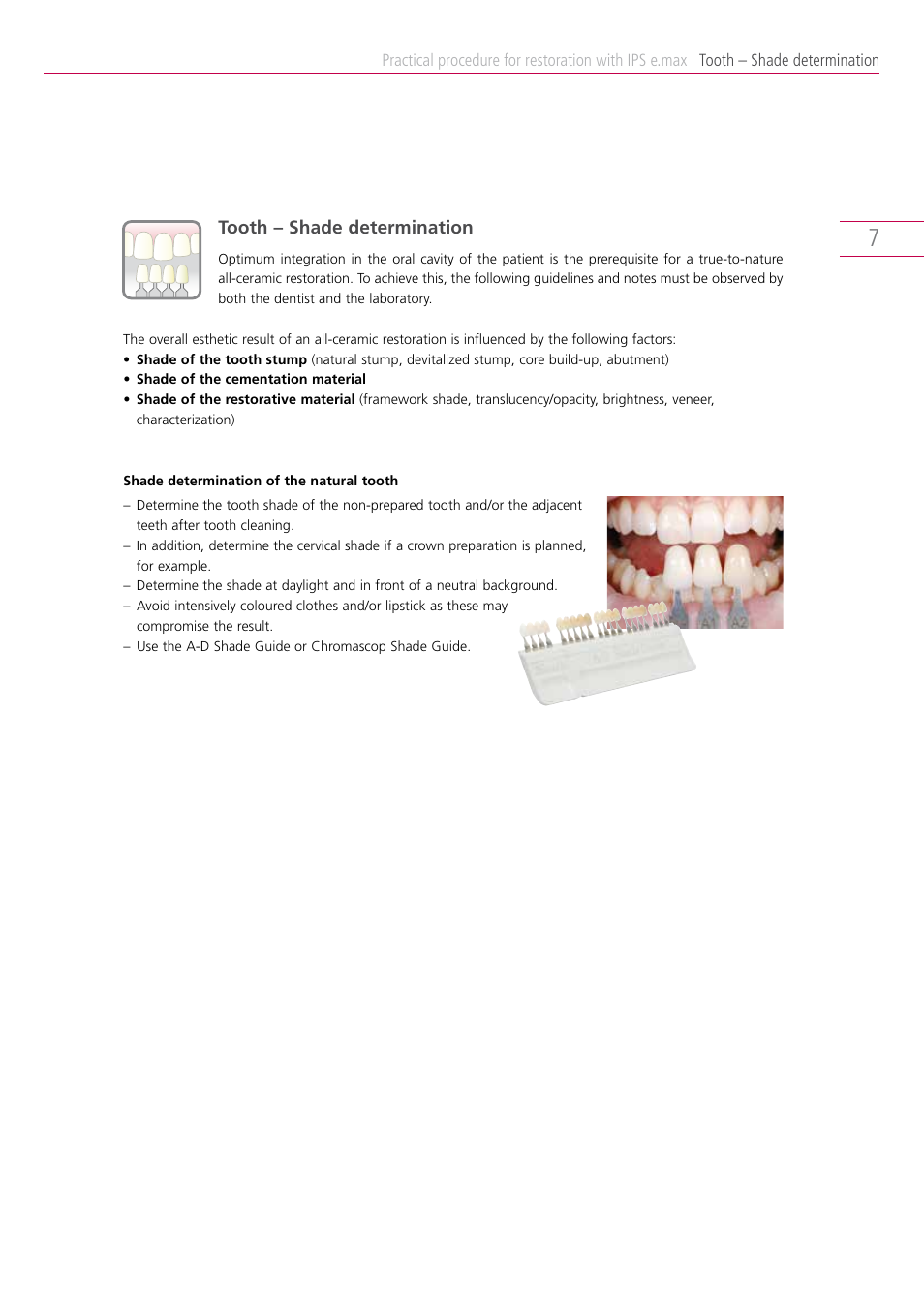 Ivoclar Vivadent IPS e.max Clinical Guide User Manual | Page 7 / 44