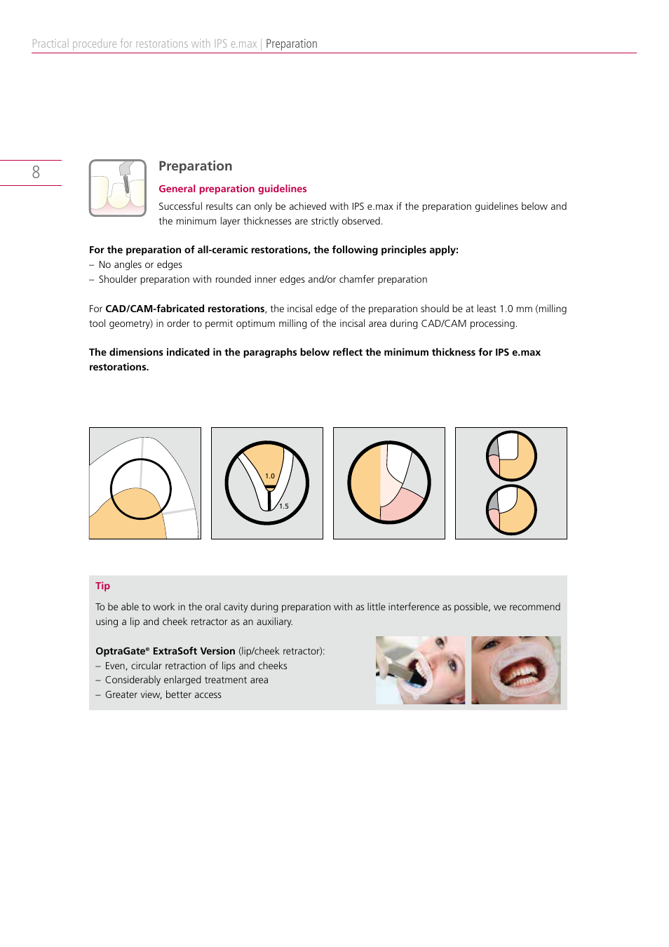 Preparation | Ivoclar Vivadent IPS e.max Clinical Guide User Manual | Page 8 / 44