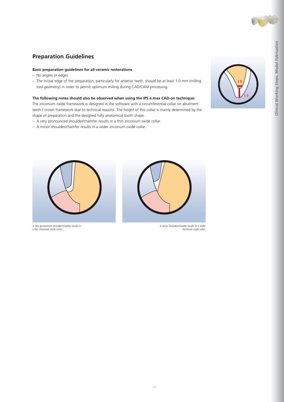 Preparation guidelines | Ivoclar Vivadent IPS e.max CAD-on User Manual | Page 15 / 52