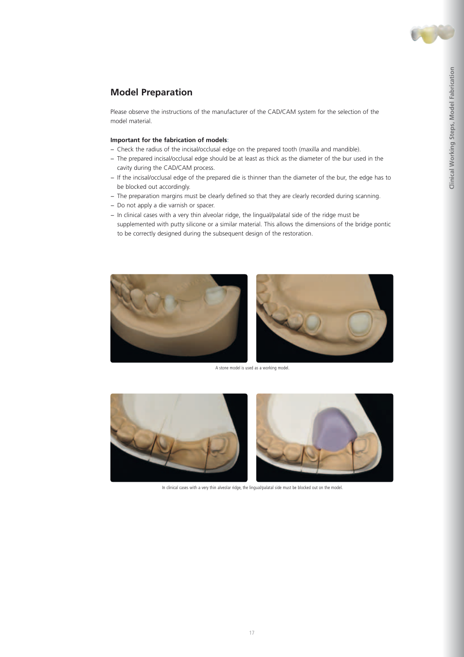 Model preparation | Ivoclar Vivadent IPS e.max CAD-on User Manual | Page 17 / 52