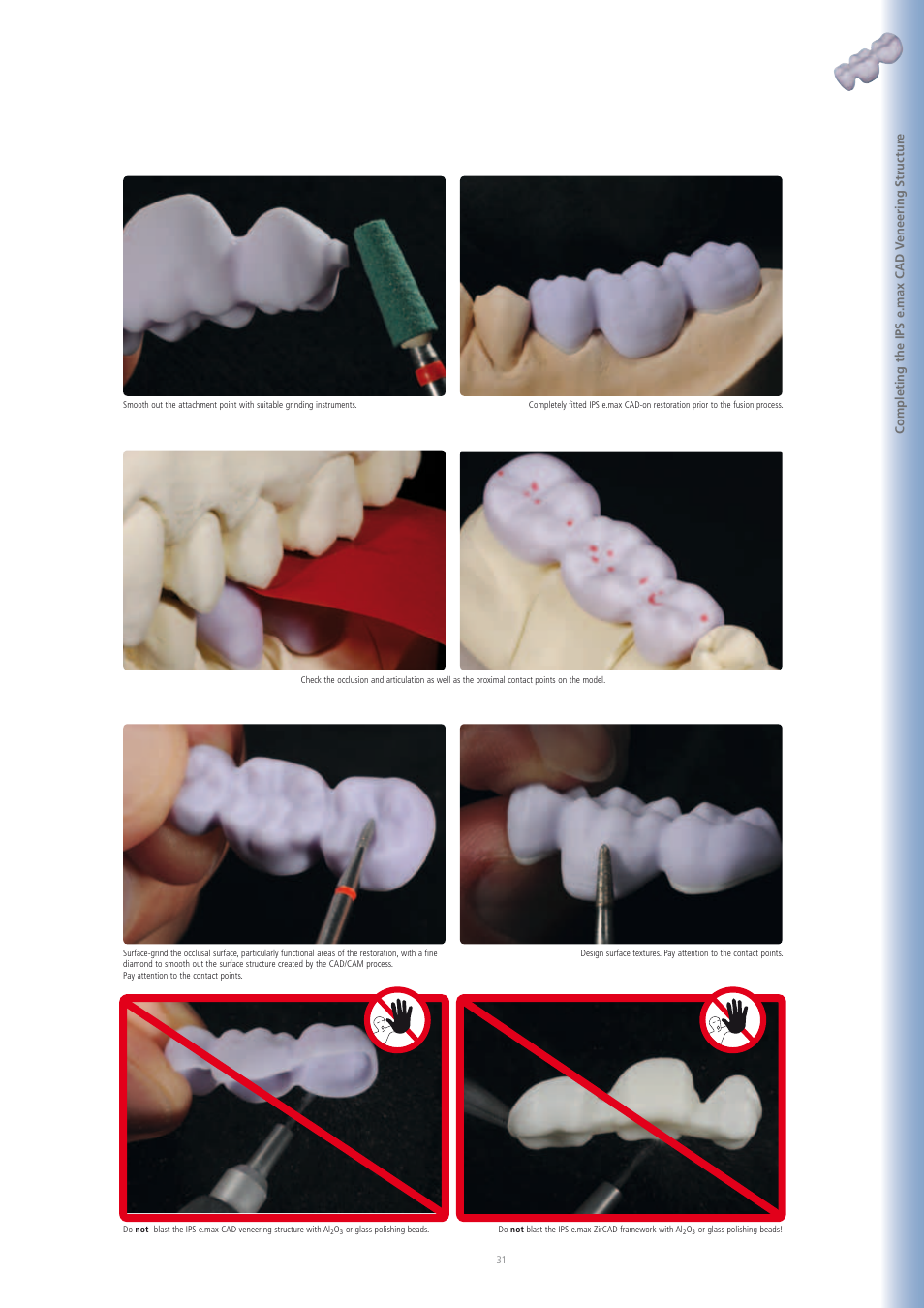 Ivoclar Vivadent IPS e.max CAD-on User Manual | Page 31 / 52