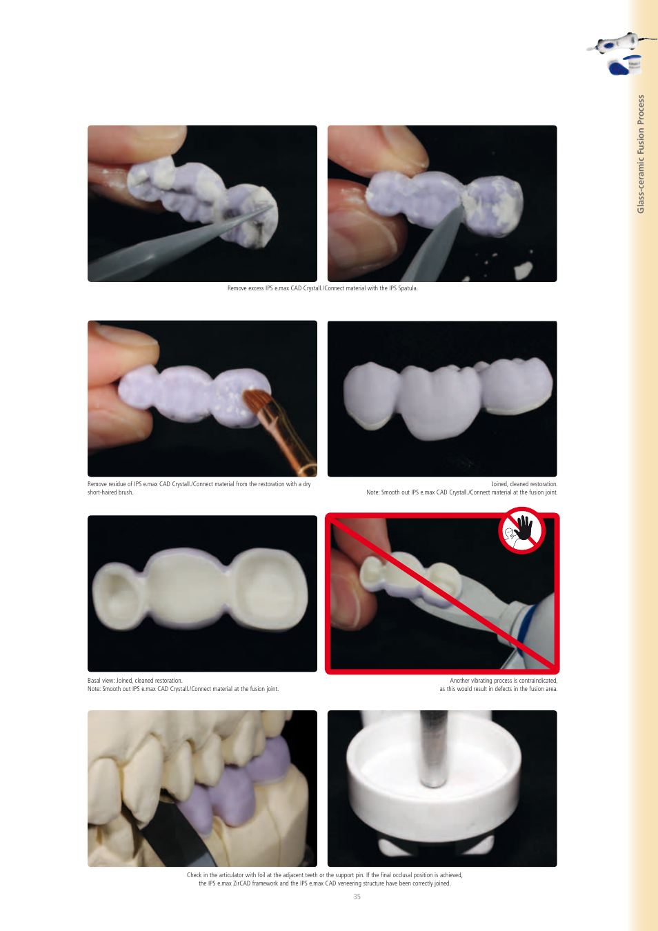 Ivoclar Vivadent IPS e.max CAD-on User Manual | Page 35 / 52