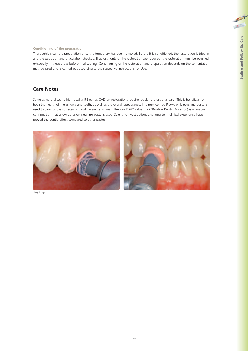 Ivoclar Vivadent IPS e.max CAD-on User Manual | Page 45 / 52