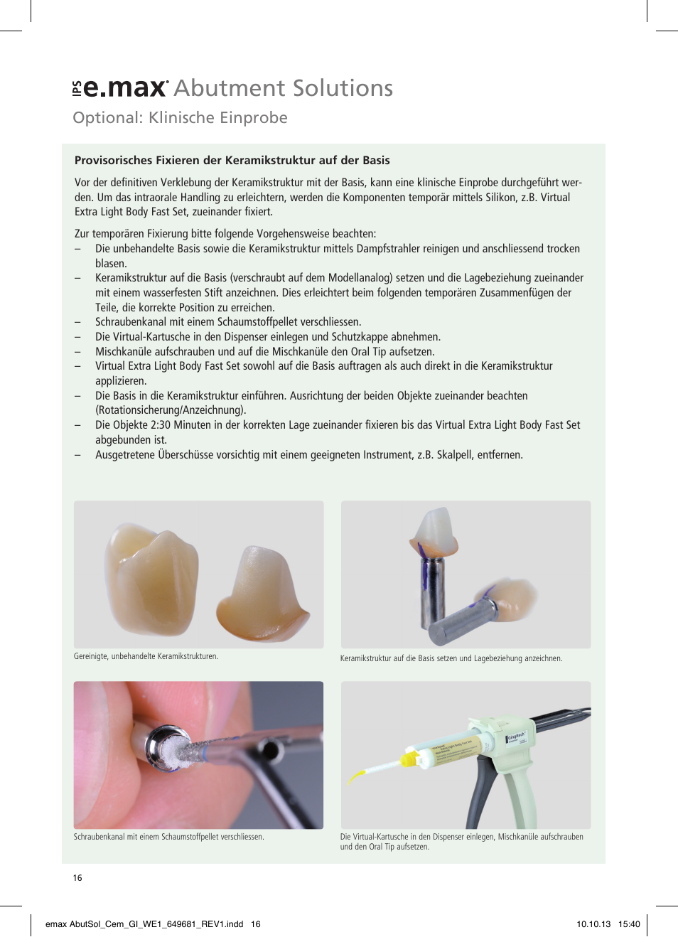Abutment solutions, Optional: klinische einprobe | Ivoclar Vivadent IPS e.max Abutment Solutions Cem Kit User Manual | Page 16 / 80