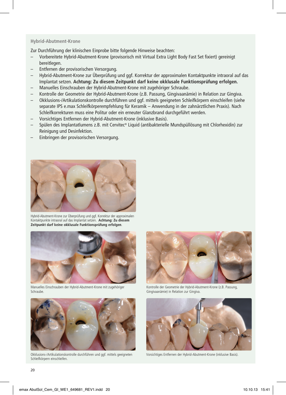Ivoclar Vivadent IPS e.max Abutment Solutions Cem Kit User Manual | Page 20 / 80
