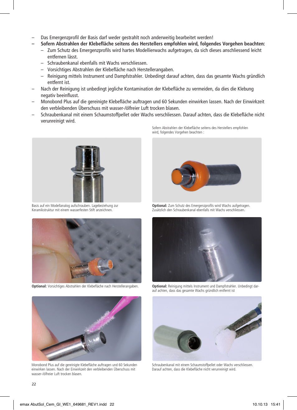 Ivoclar Vivadent IPS e.max Abutment Solutions Cem Kit User Manual | Page 22 / 80