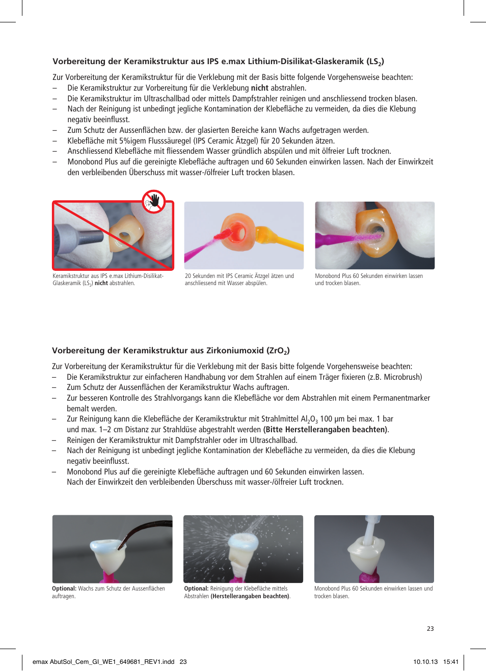 Ivoclar Vivadent IPS e.max Abutment Solutions Cem Kit User Manual | Page 23 / 80