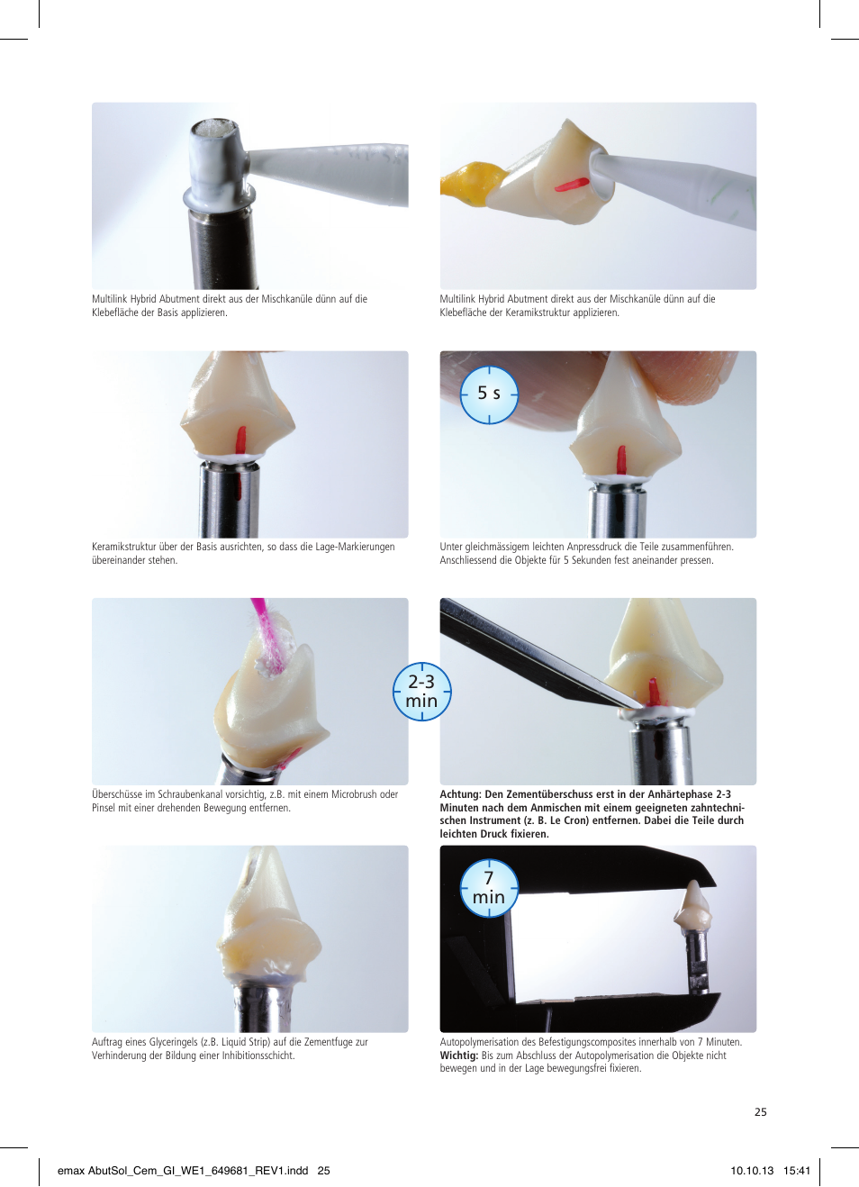 5 s 7 min 2-3 min | Ivoclar Vivadent IPS e.max Abutment Solutions Cem Kit User Manual | Page 25 / 80