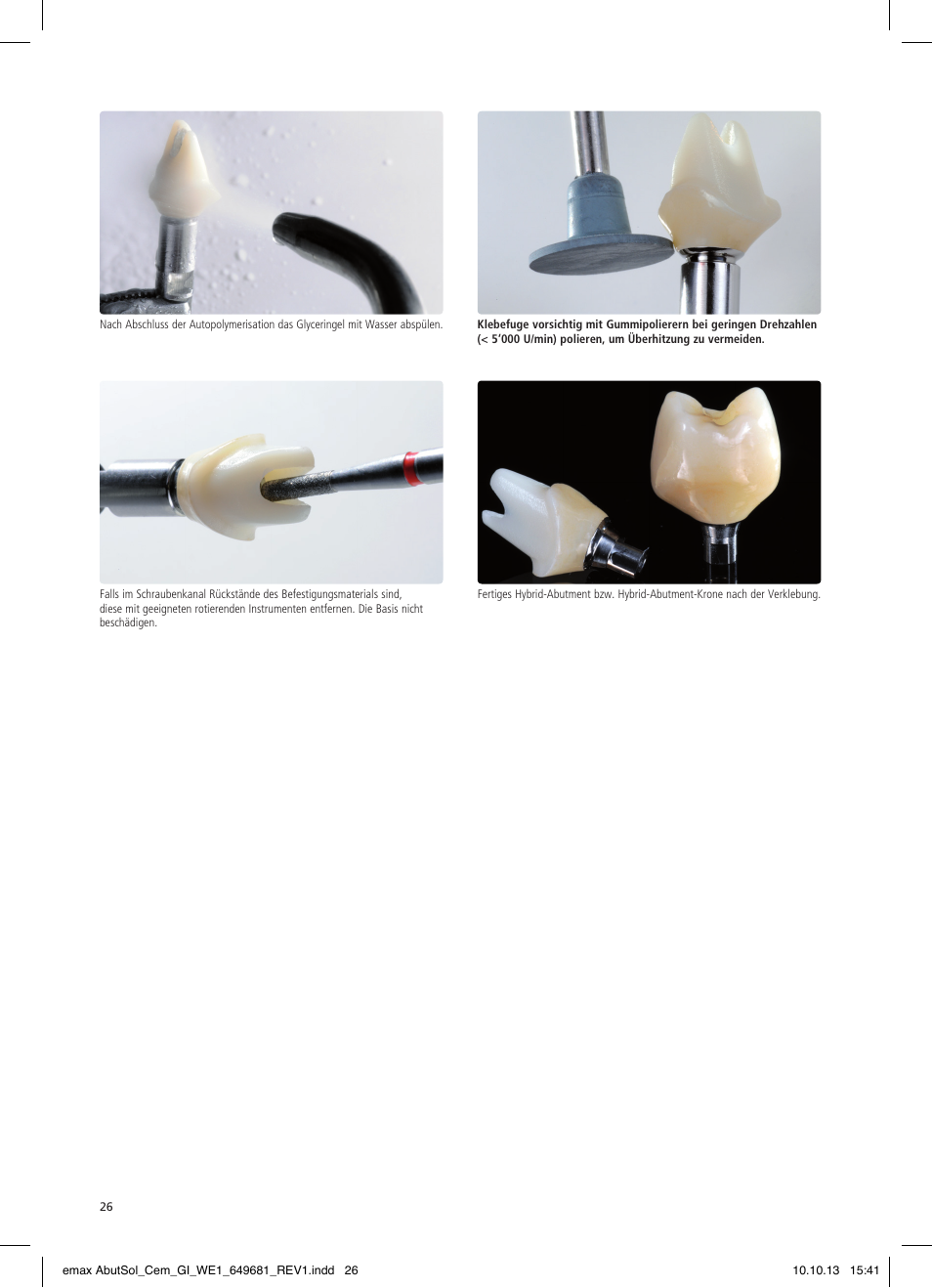 Ivoclar Vivadent IPS e.max Abutment Solutions Cem Kit User Manual | Page 26 / 80