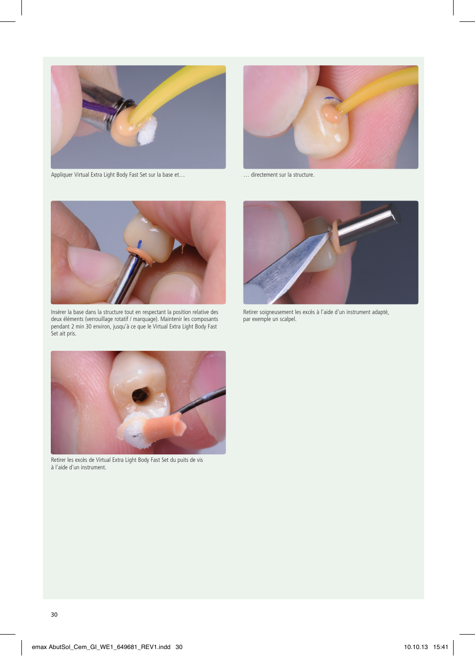 Ivoclar Vivadent IPS e.max Abutment Solutions Cem Kit User Manual | Page 30 / 80