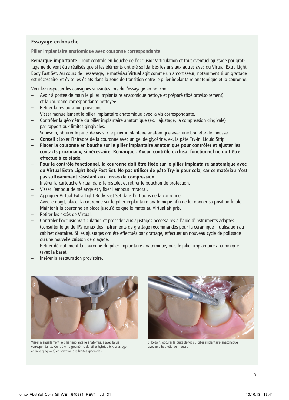 Ivoclar Vivadent IPS e.max Abutment Solutions Cem Kit User Manual | Page 31 / 80