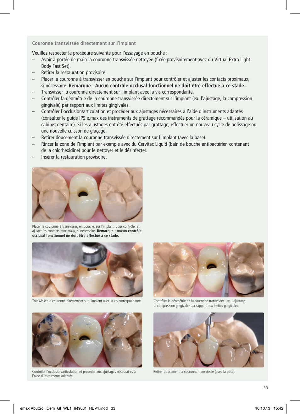 Ivoclar Vivadent IPS e.max Abutment Solutions Cem Kit User Manual | Page 33 / 80