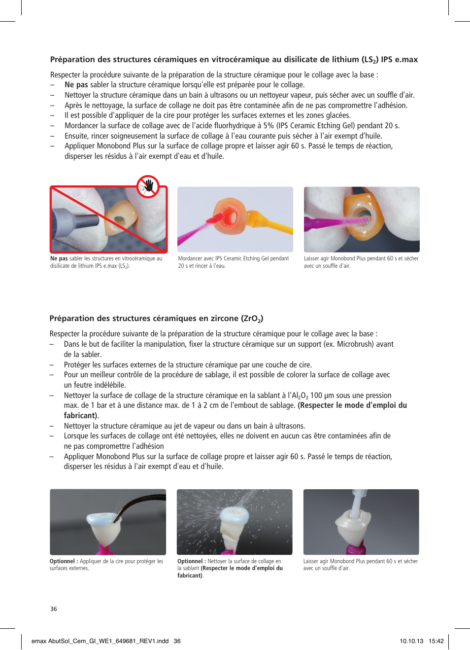 Ivoclar Vivadent IPS e.max Abutment Solutions Cem Kit User Manual | Page 36 / 80