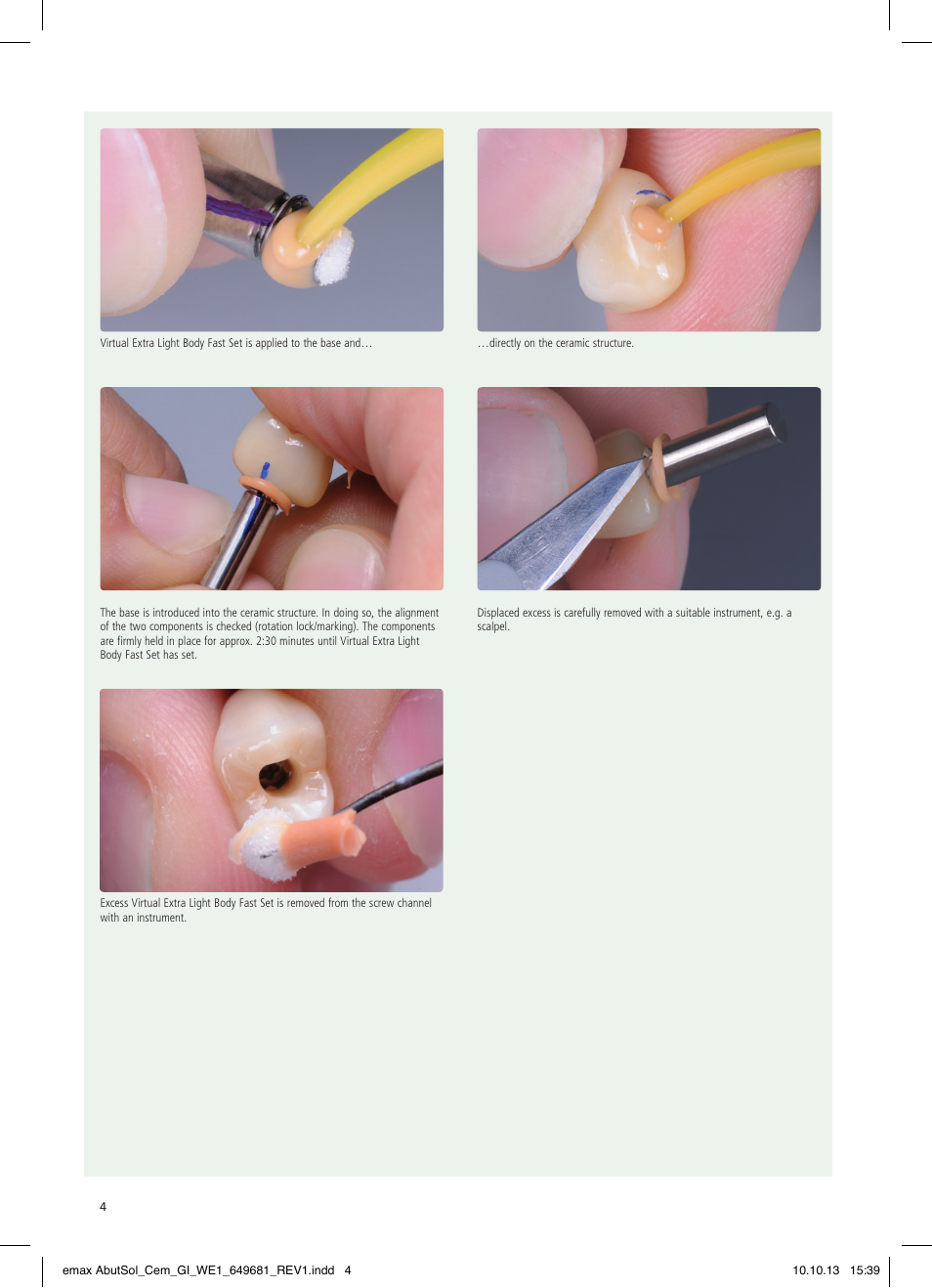 Ivoclar Vivadent IPS e.max Abutment Solutions Cem Kit User Manual | Page 4 / 80