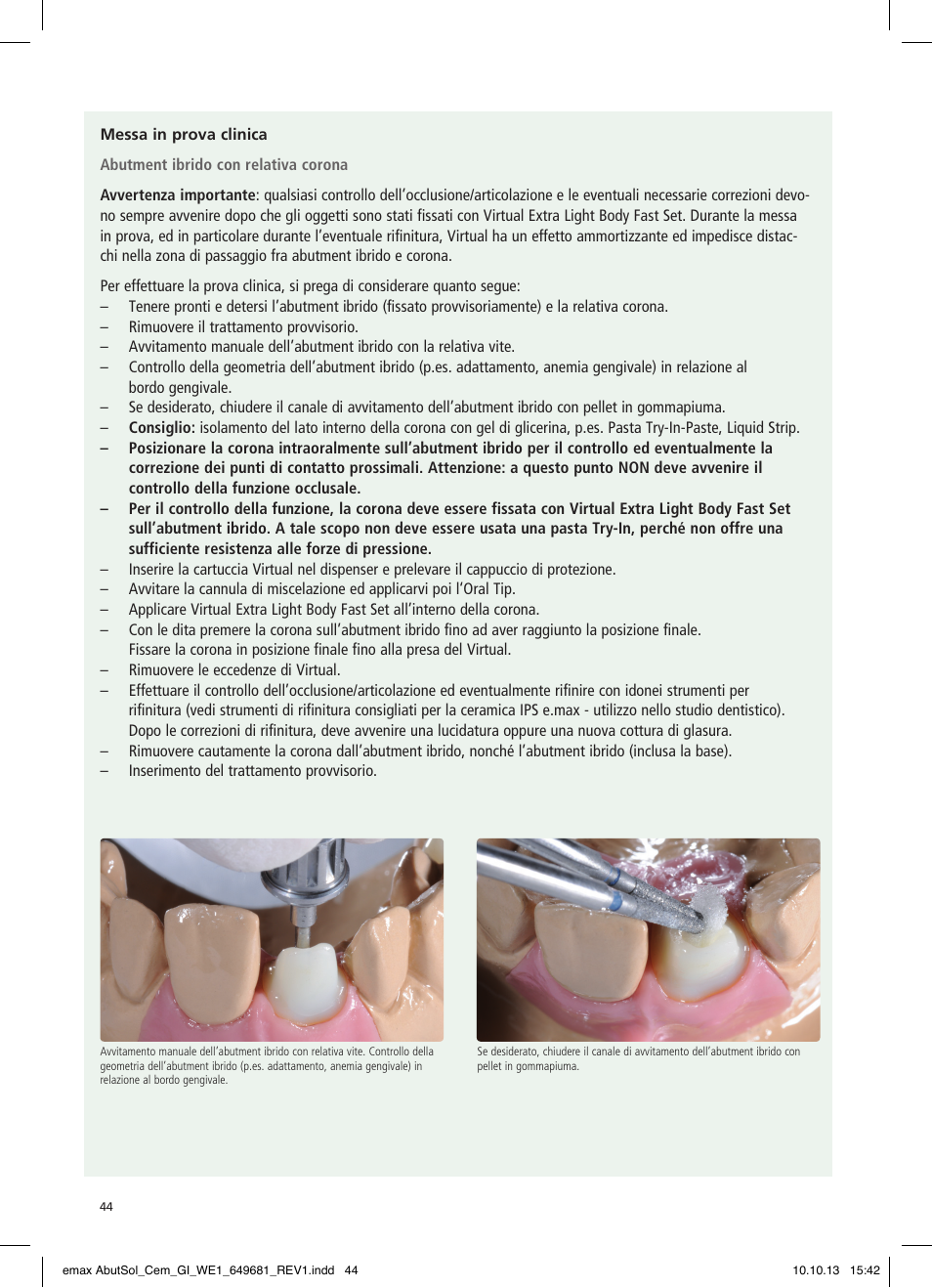 Ivoclar Vivadent IPS e.max Abutment Solutions Cem Kit User Manual | Page 44 / 80