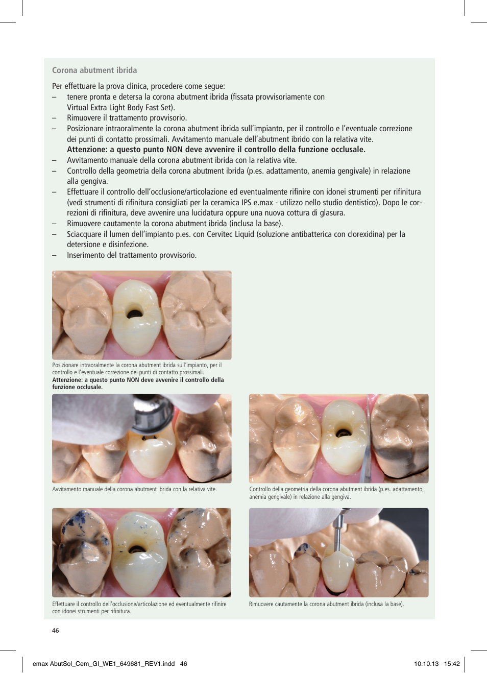 Ivoclar Vivadent IPS e.max Abutment Solutions Cem Kit User Manual | Page 46 / 80