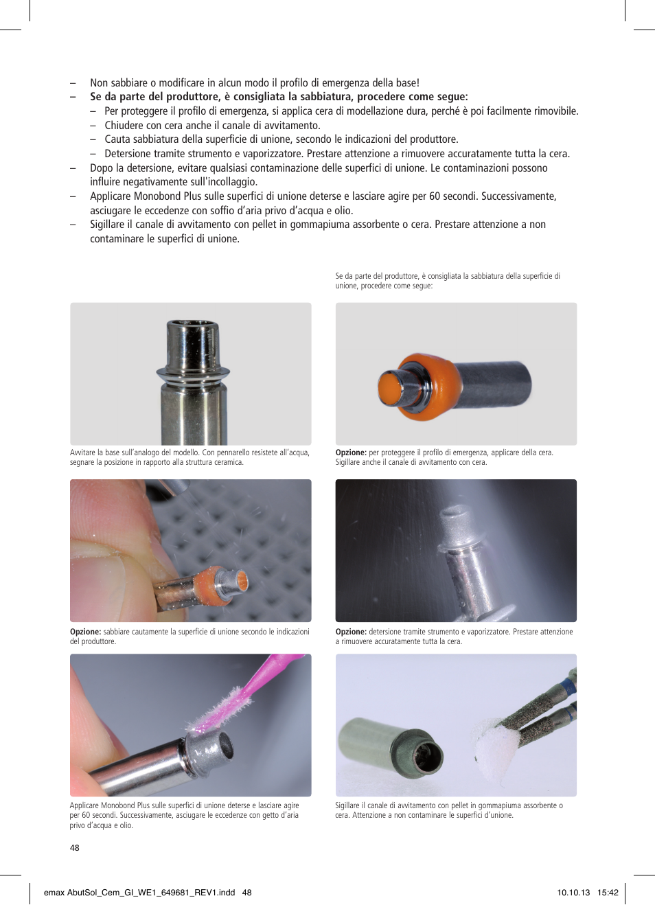 Ivoclar Vivadent IPS e.max Abutment Solutions Cem Kit User Manual | Page 48 / 80