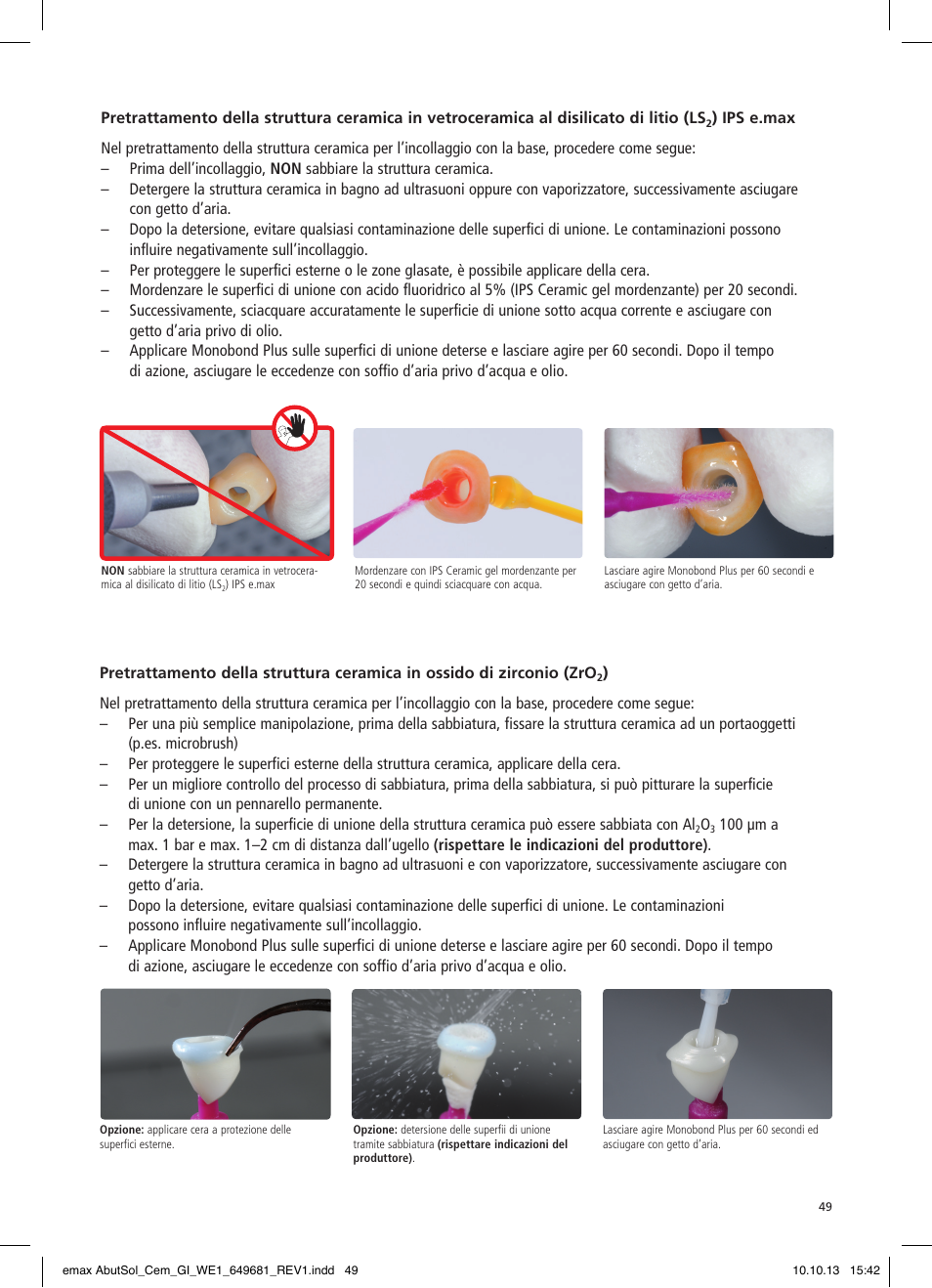 Ivoclar Vivadent IPS e.max Abutment Solutions Cem Kit User Manual | Page 49 / 80