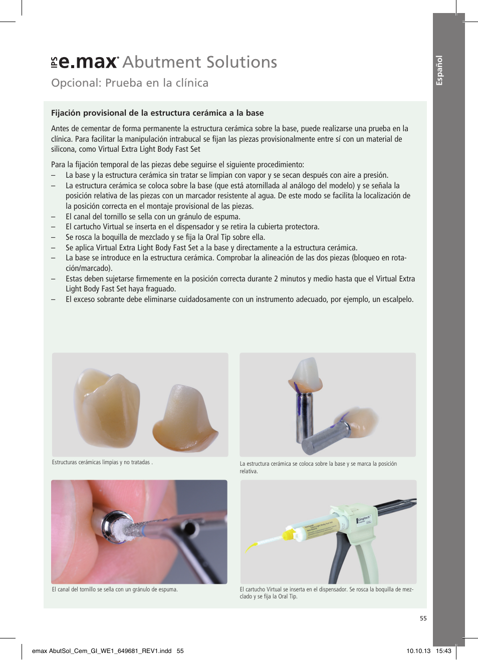 Español, Abutment solutions, Opcional: prueba en la clínica | Ivoclar Vivadent IPS e.max Abutment Solutions Cem Kit User Manual | Page 55 / 80