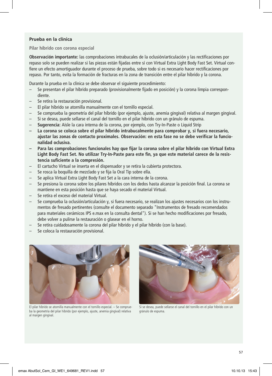 Ivoclar Vivadent IPS e.max Abutment Solutions Cem Kit User Manual | Page 57 / 80