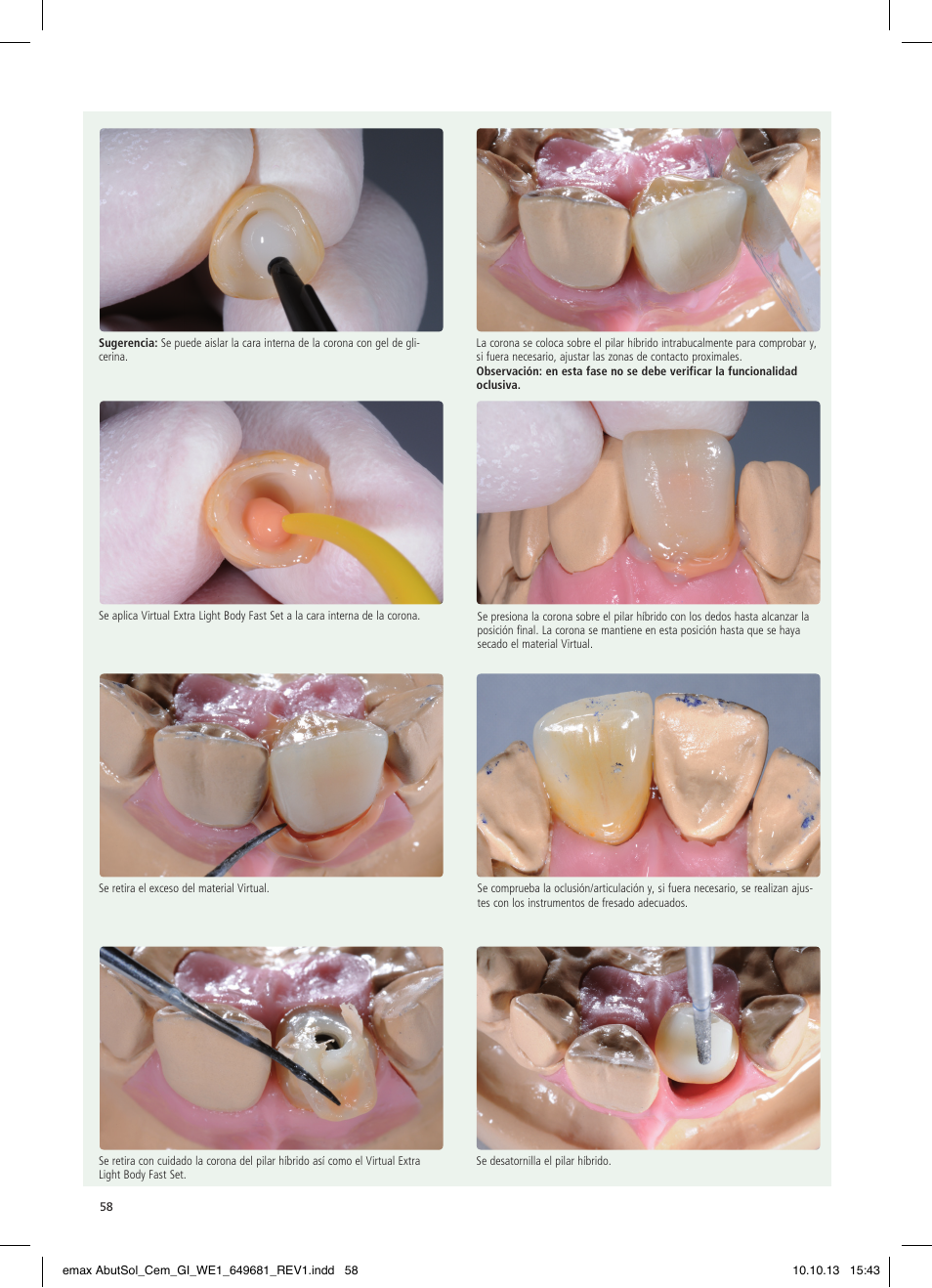 Ivoclar Vivadent IPS e.max Abutment Solutions Cem Kit User Manual | Page 58 / 80