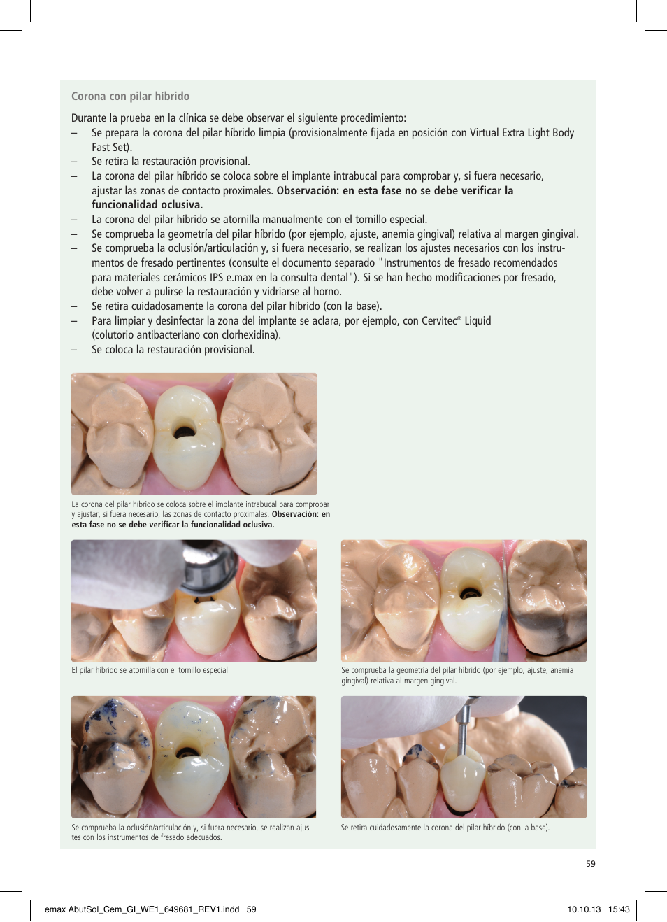 Ivoclar Vivadent IPS e.max Abutment Solutions Cem Kit User Manual | Page 59 / 80