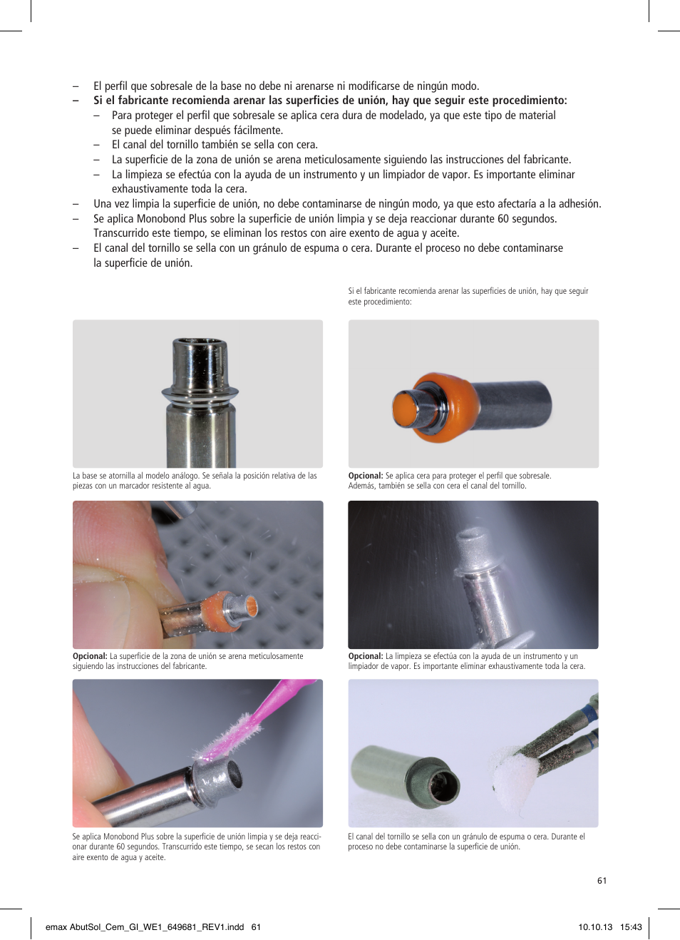 Ivoclar Vivadent IPS e.max Abutment Solutions Cem Kit User Manual | Page 61 / 80