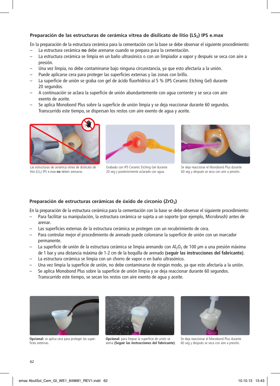 Ivoclar Vivadent IPS e.max Abutment Solutions Cem Kit User Manual | Page 62 / 80