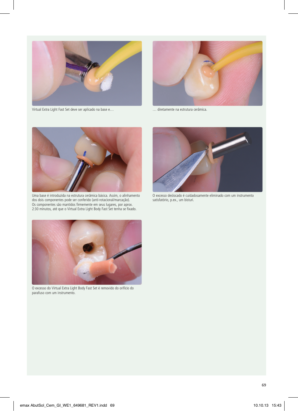 Ivoclar Vivadent IPS e.max Abutment Solutions Cem Kit User Manual | Page 69 / 80