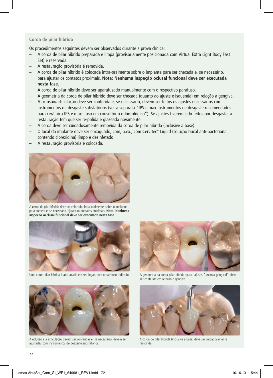 Ivoclar Vivadent IPS e.max Abutment Solutions Cem Kit User Manual | Page 72 / 80