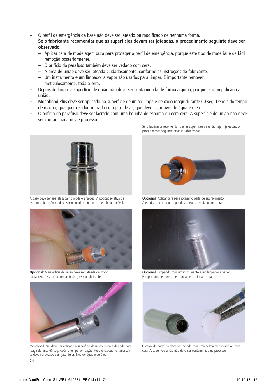 Ivoclar Vivadent IPS e.max Abutment Solutions Cem Kit User Manual | Page 74 / 80