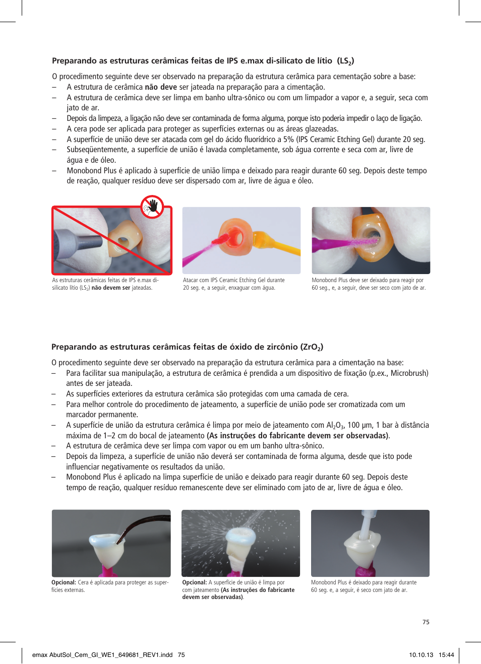 Ivoclar Vivadent IPS e.max Abutment Solutions Cem Kit User Manual | Page 75 / 80