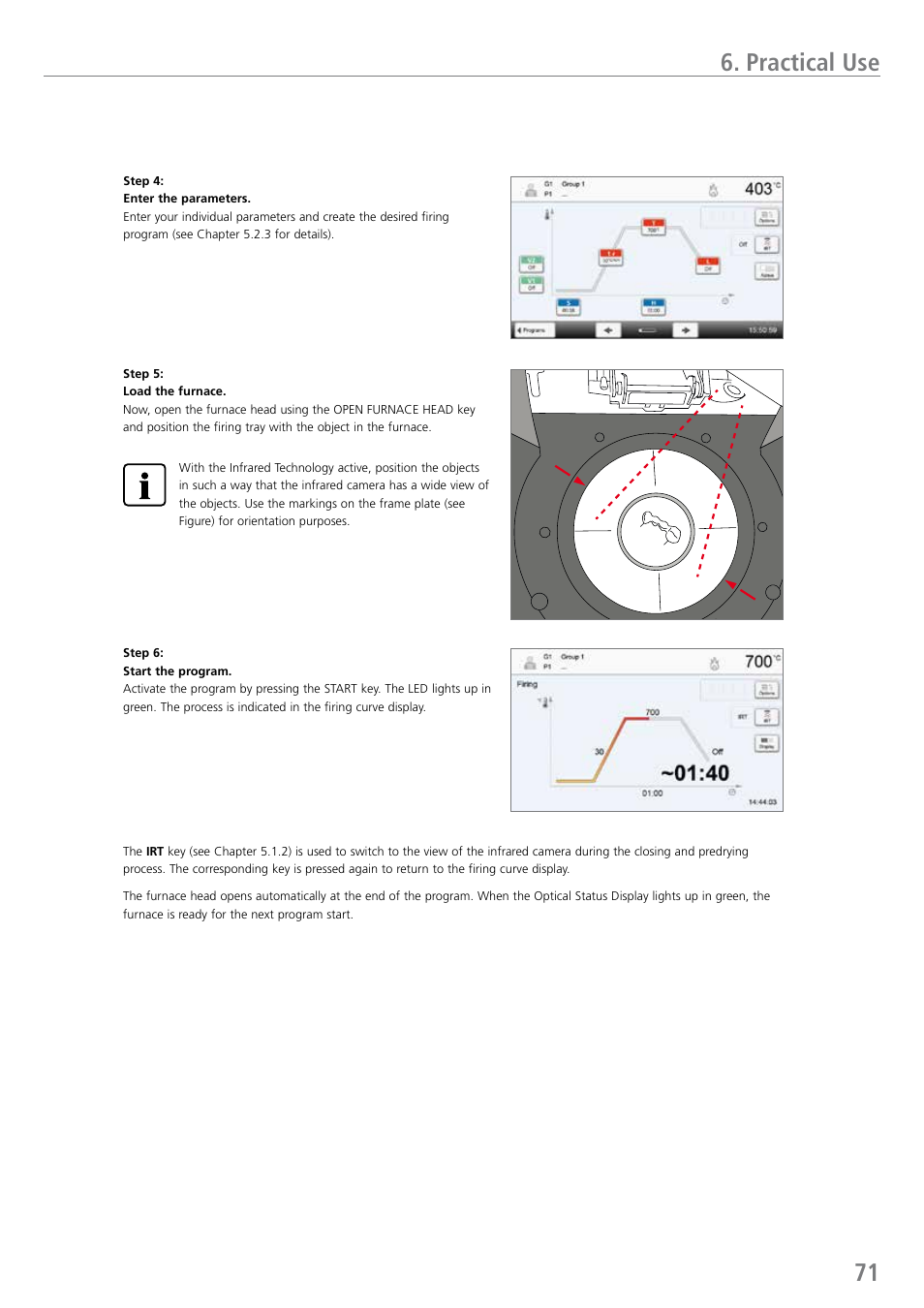 Practical use | Ivoclar Vivadent EP 5010 User Manual | Page 71 / 92