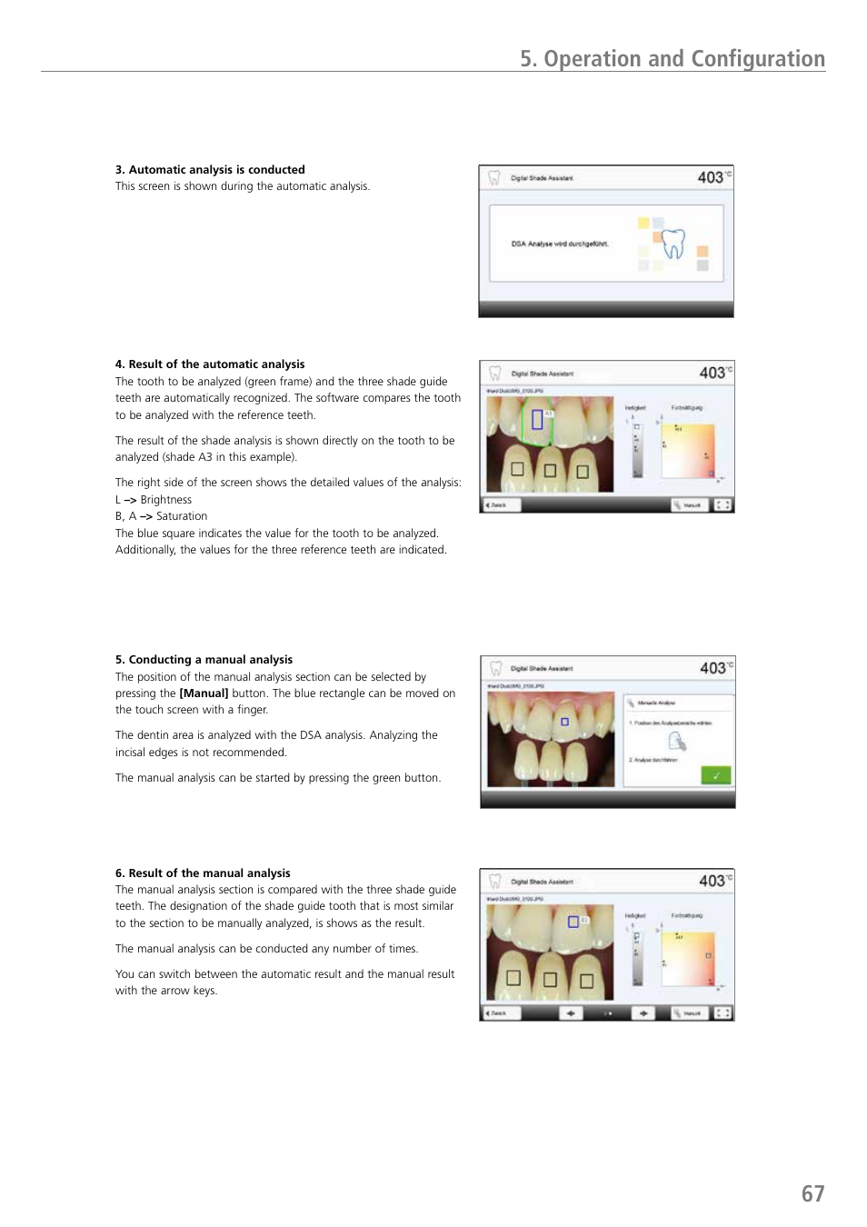 67 5. operation and configuration | Ivoclar Vivadent P710 User Manual | Page 67 / 88