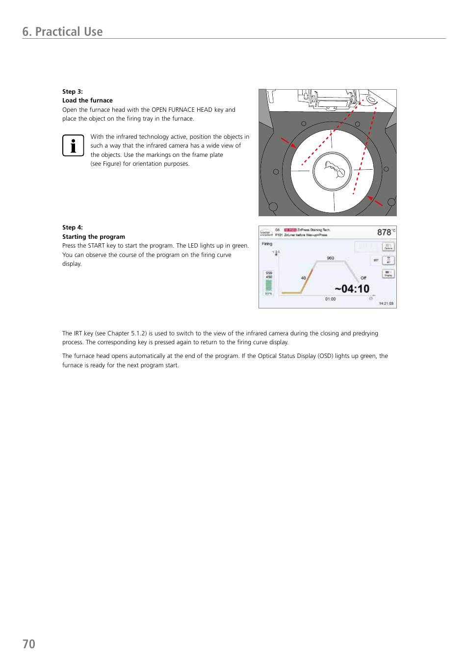 Practical use | Ivoclar Vivadent P710 User Manual | Page 70 / 88