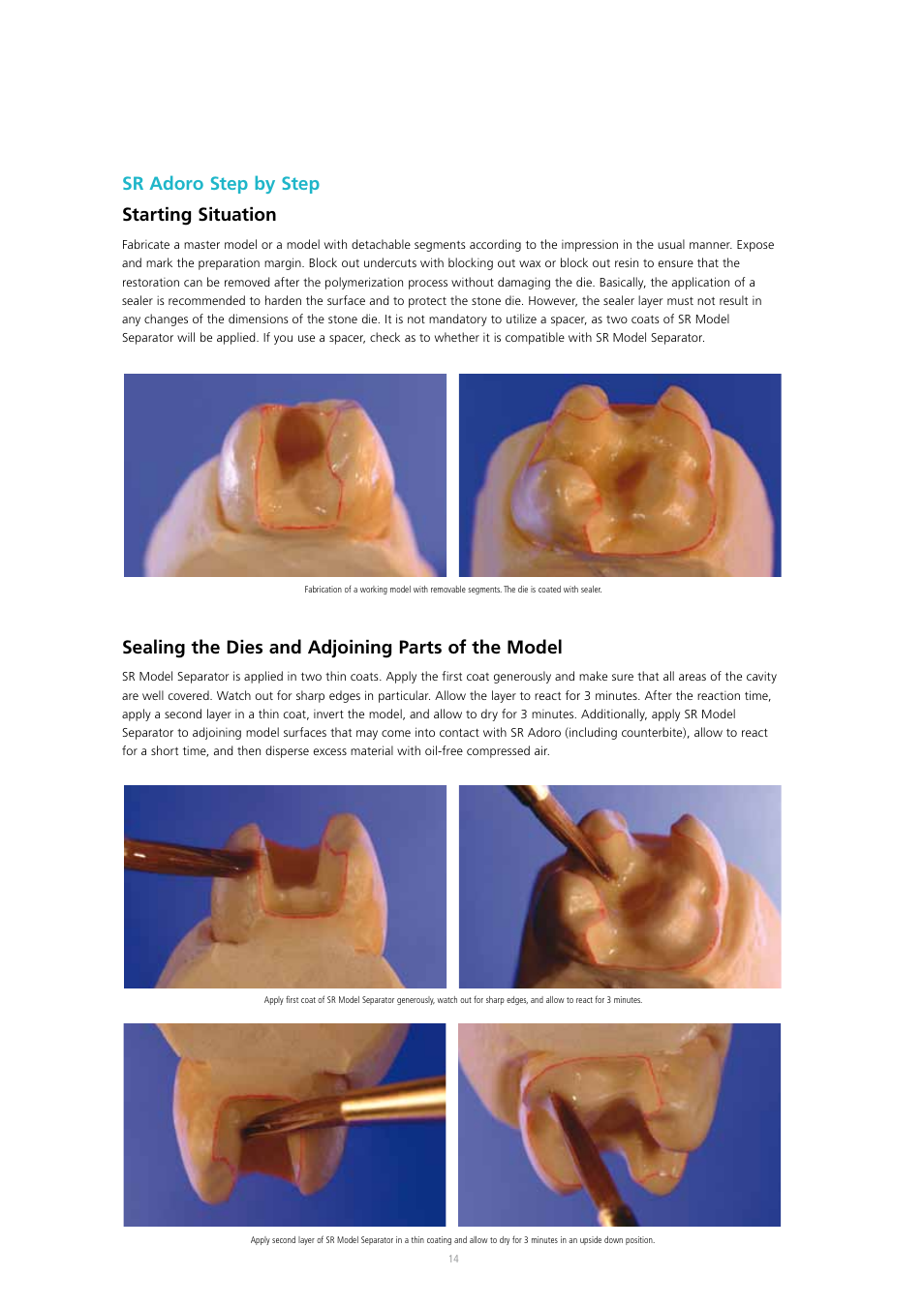 Sr adoro step by step starting situation, Sealing the dies and adjoining parts of the model | Ivoclar Vivadent SR Adoro User Manual | Page 14 / 88