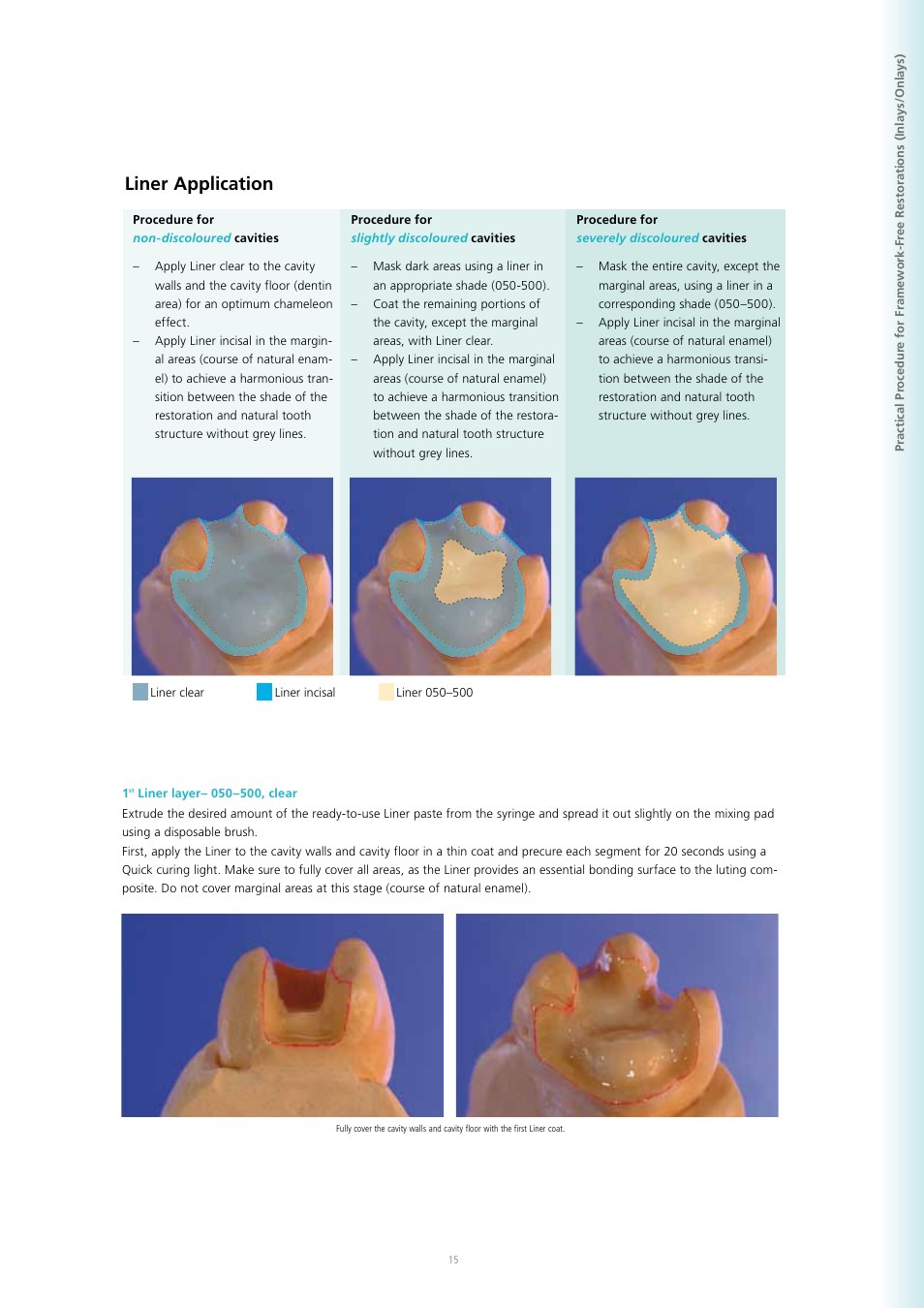 Liner application | Ivoclar Vivadent SR Adoro User Manual | Page 15 / 88