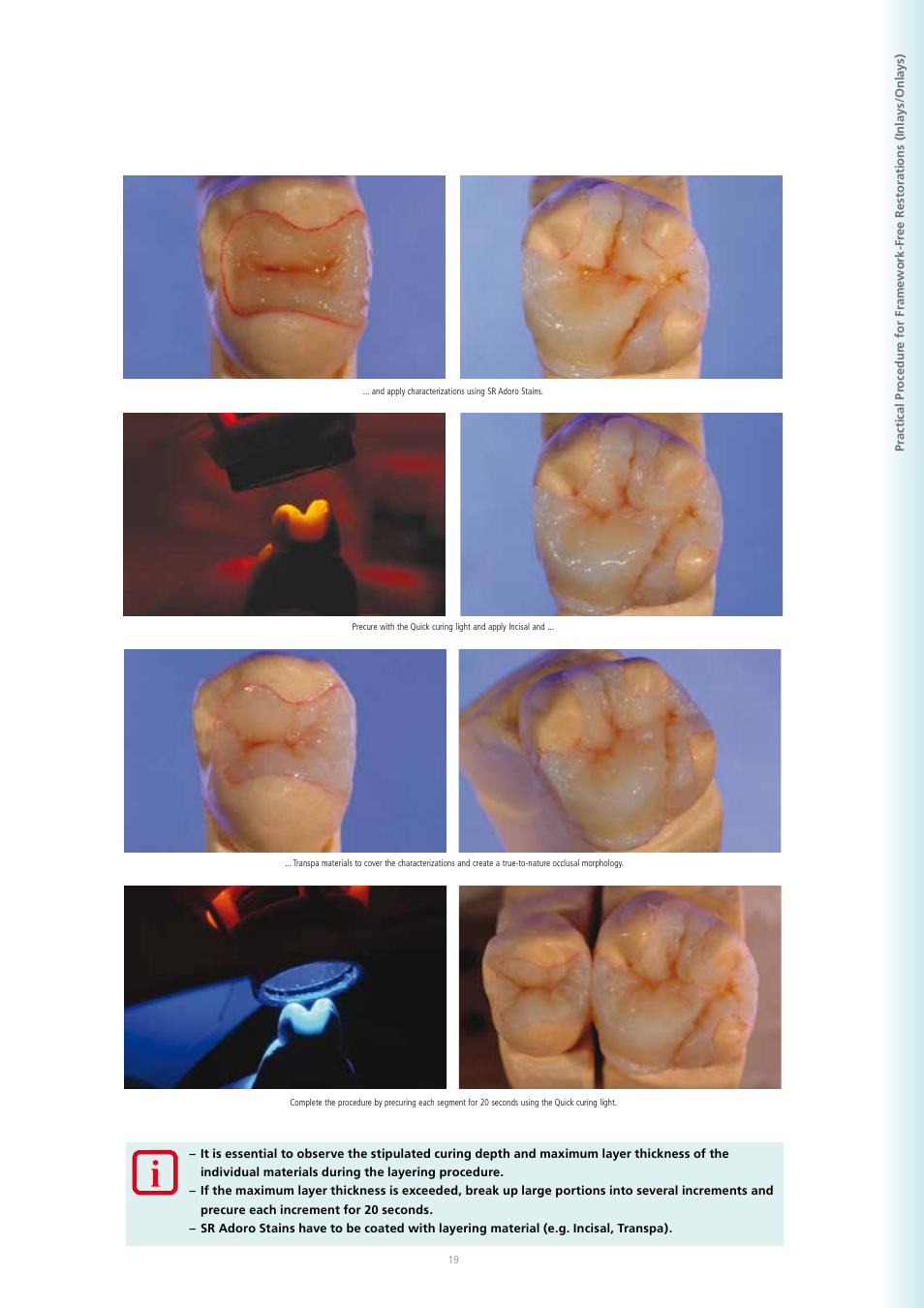 Ivoclar Vivadent SR Adoro User Manual | Page 19 / 88
